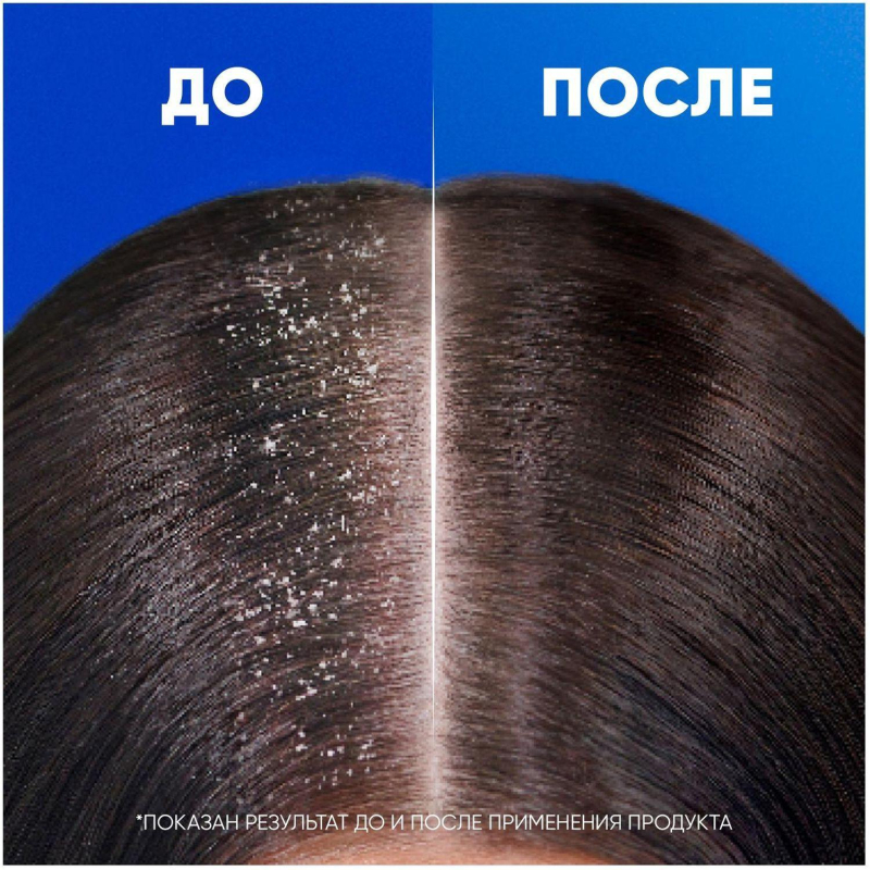 Шампунь HEAD & SHOULDERS против перхоти Яблочная свежесть 400мл - фото 4