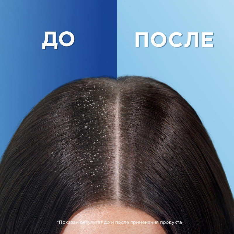 Шампунь HEAD & SHOULDERS основной уход  400 мл - фото 4