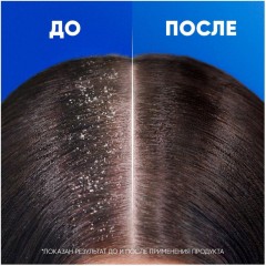 Шампунь HEAD & SHOULDERS против перхоти Яблочная свежесть 400мл Шампунь HEAD & SHOULDERS против перхоти Яблочная свежесть 400мл - фото 4